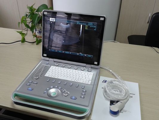 3D Digital Laptop portabel Ultrasound Scanner dengan semua jenis Probe